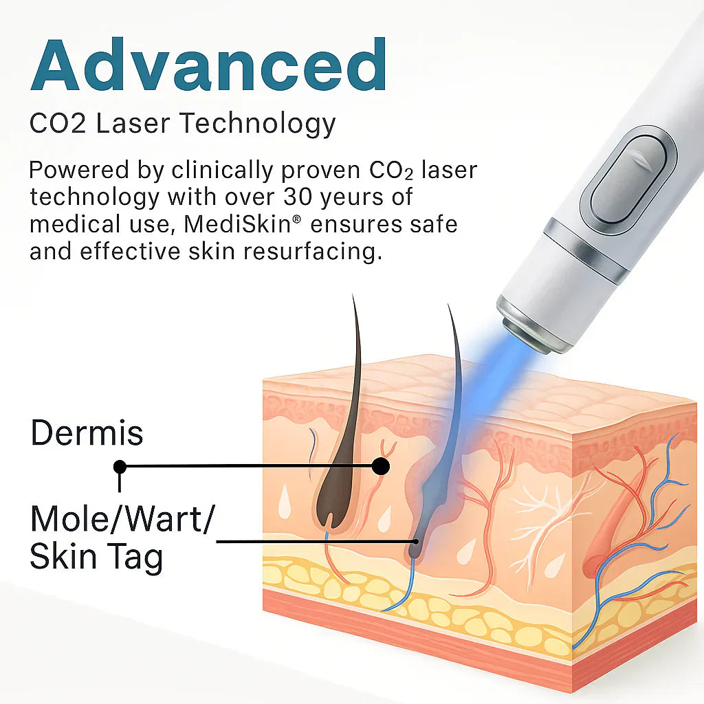 Blue laser pen for stain removal